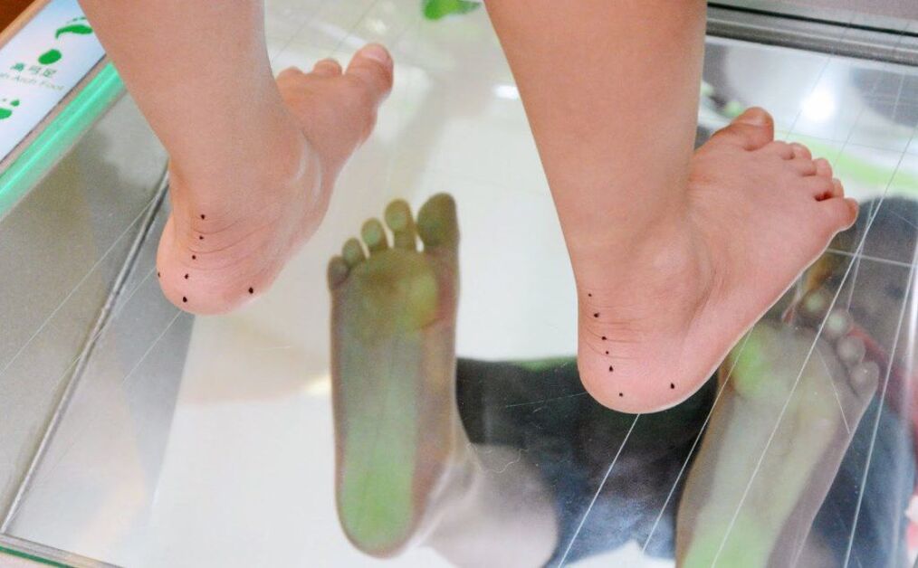 Φυτογραφία