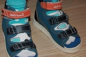 φορώντας σανδάλια για hallux valgus σε ένα παιδί